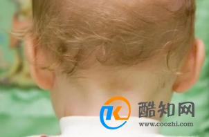 宝宝怎样睡头型好看？